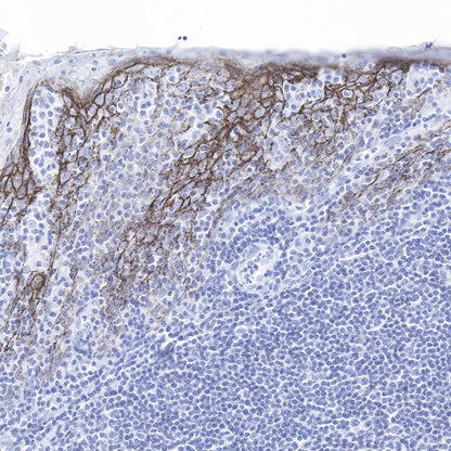 Claudin-1 Recombinant Rabbit mAb,PBS Only (SDT-R024)