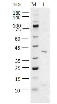 JAK3(JH1) His Tag Protein, Human