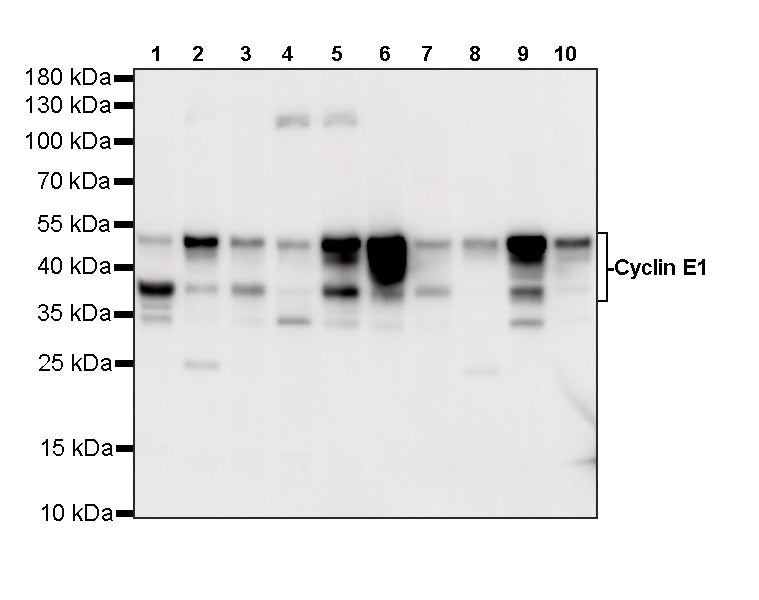 Cyclin E1 Recombinant Rabbit mAb (SDT-4375-44)