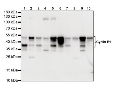 Cyclin E1 Recombinant Rabbit mAb (SDT-4375-44)