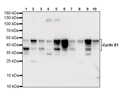 Cyclin E1 Recombinant Rabbit mAb (SDT-4375-44)