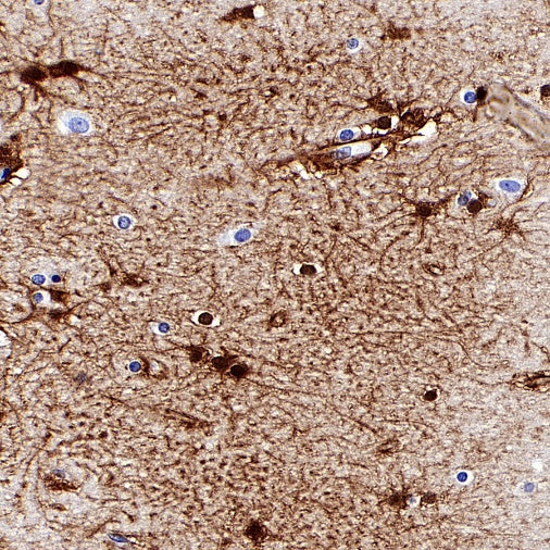 FABP7 Recombinant Rabbit mAb (S-762-114)