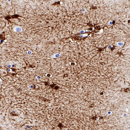 FABP7 Recombinant Rabbit mAb (S-762-114)