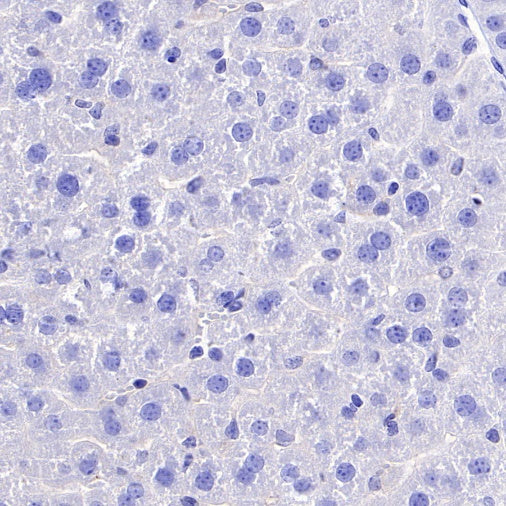 Vesicular Glutamate Transporter 1 (VGLUT1) Recombinant Rabbit mAb (S-1118-58)