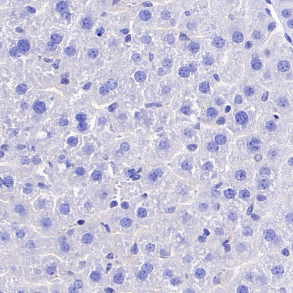 Vesicular Glutamate Transporter 1 (VGLUT1) Recombinant Rabbit mAb (S-1118-58)