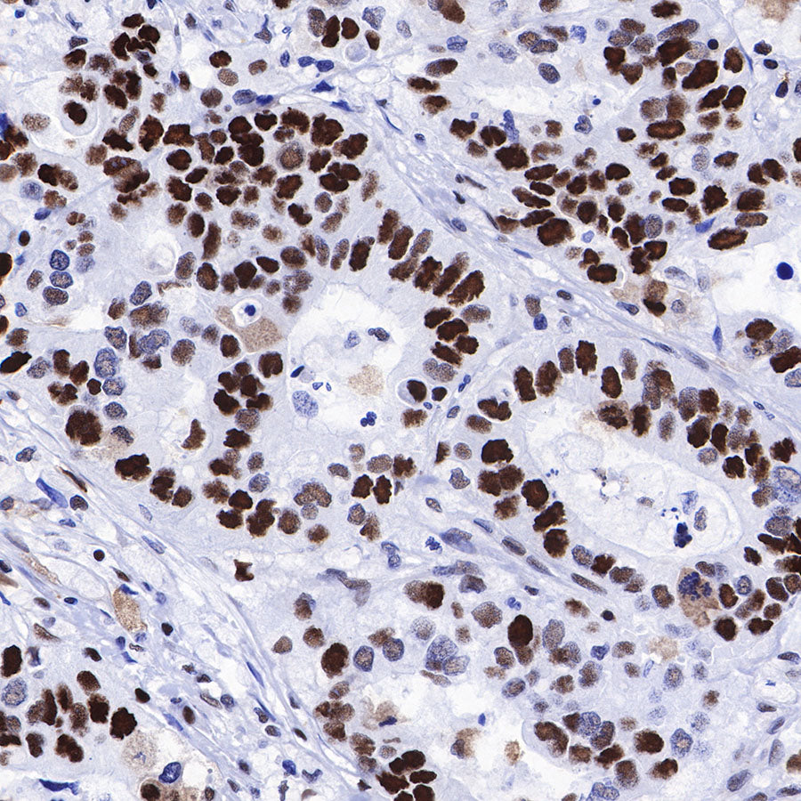 S-RMab® MCM2 Recombinant Rabbit mAb (SDT-018-68)