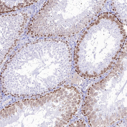 Rad51 Recombinant Rabbit mAb (S-R347)