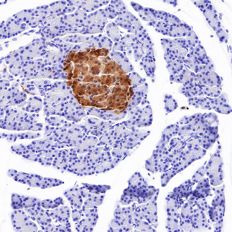 PGP9.5 Recombinant Mouse mAb (S-6071)