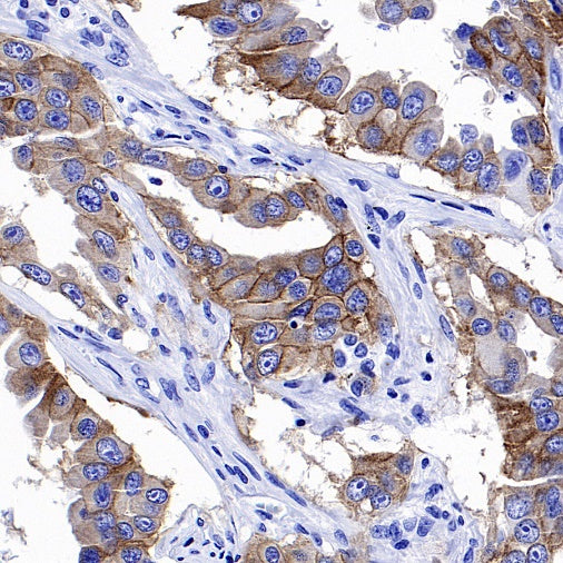 EGFR (L858R) Recombinant Rabbit mAb (SDT-421-202)