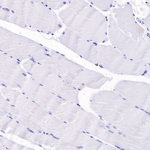 CD5 Recombinant Rabbit mAb (SDT-2570-53)