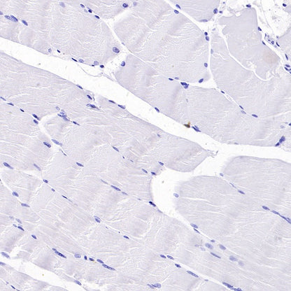 CD5 Recombinant Rabbit mAb (SDT-2570-53)
