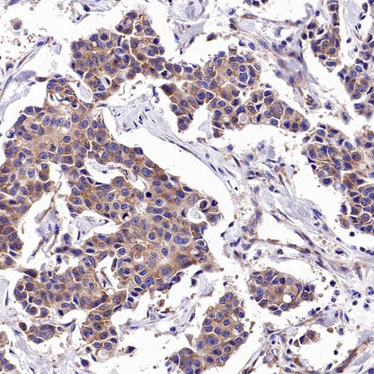 Argonaute 2 Recombinant Rabbit mAb (S-2620-13)