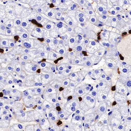 S100A8/MRP8 Recombinant Rabbit mAb (S-R251)