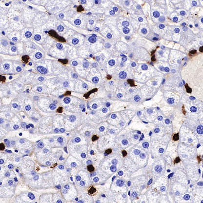 S100A8/MRP8 Recombinant Rabbit mAb (S-R251)