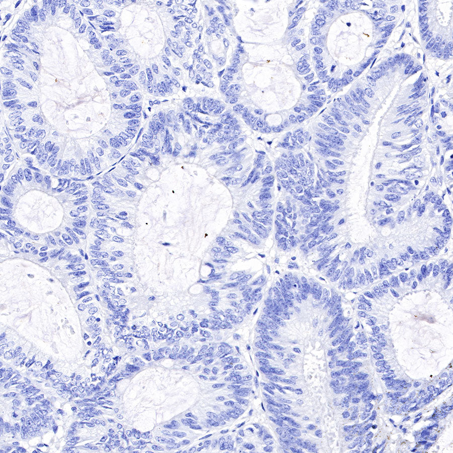 PAPP-A Recombinant Rabbit mAb (SDT-226-46)