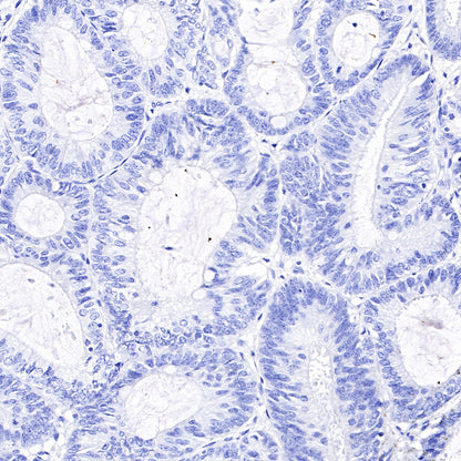 PAPP-A Recombinant Rabbit mAb (SDT-226-46)