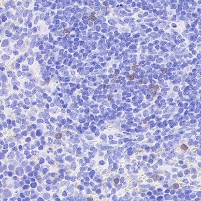 NKR-P1C Recombinant Rabbit mAb (S-4706)