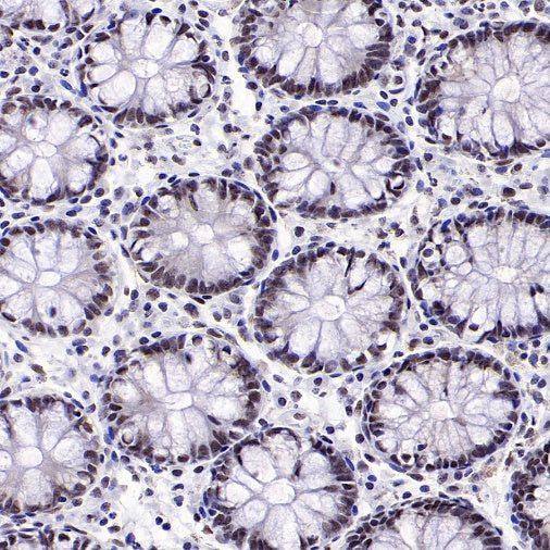 RNF40 Recombinant Rabbit mAb (S-1068-279)