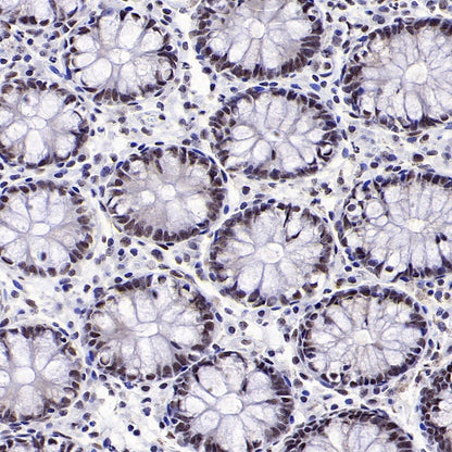 RNF40 Recombinant Rabbit mAb (S-1068-279)