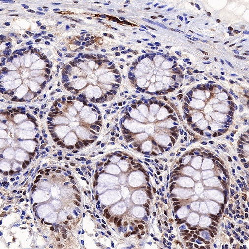 SQSTM1/p62 Recombinant Rabbit mAb (S-R346)