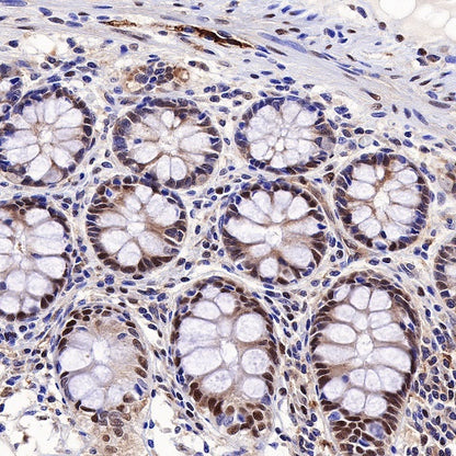 SQSTM1/p62 Recombinant Rabbit mAb (S-R346)