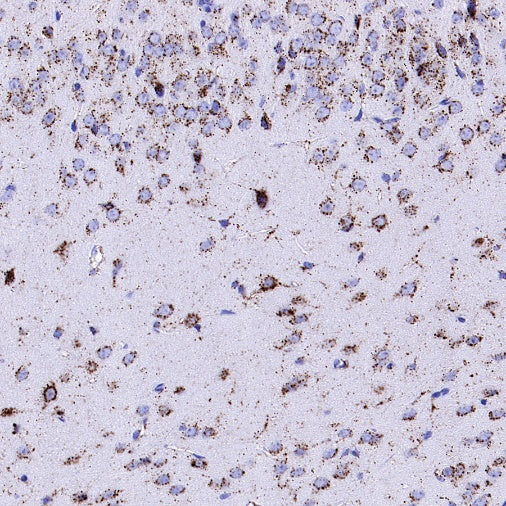 Cathepsin D Recombinant Rabbit mAb (S-R208)
