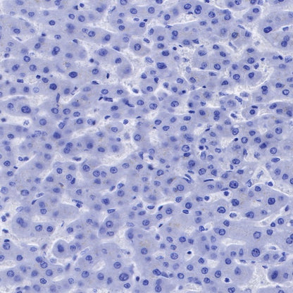 CD90 Recombinant Rabbit mAb (SDT-349-164)
