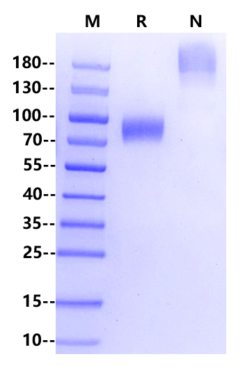 IL-2 Rγ/CD132 Fc Chimera Protein, Human