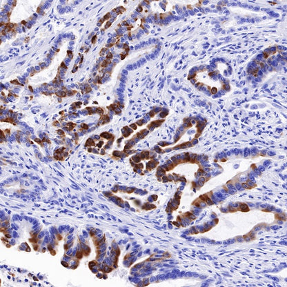 TFF1 Recombinant Rabbit mAb (S-481-16)