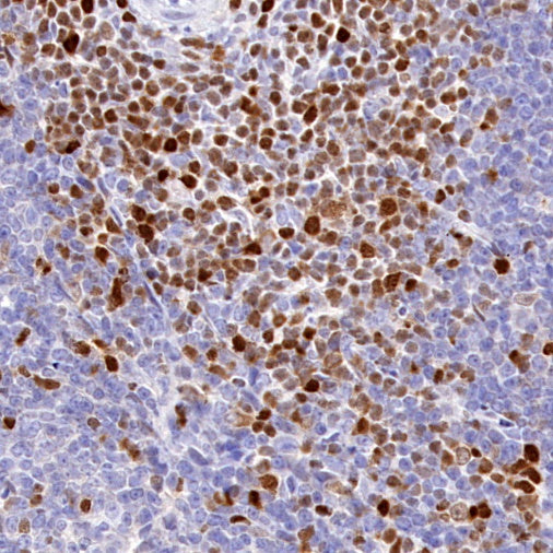 TOX Recombinant Rabbit mAb (S-2296-44)
