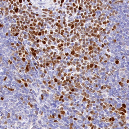 TOX Recombinant Rabbit mAb (S-2296-44)