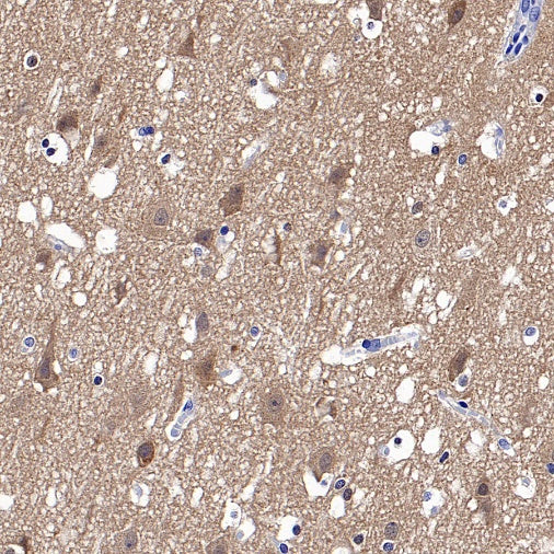 HPRT1 Rabbit Polyclonal Antibody