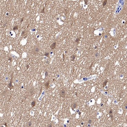 HPRT1 Rabbit Polyclonal Antibody
