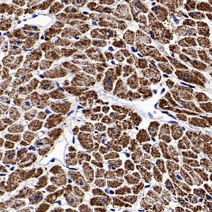 Parkin Rabbit Polyclonal Antibody