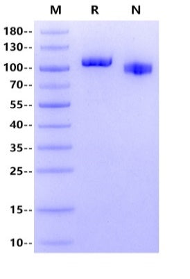 ErbB3/Her3 His Tag Protein, Human