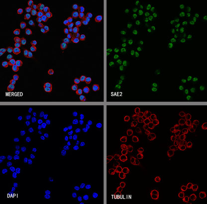 SAE2 Recombinant Rabbit mAb (S-4888-5)