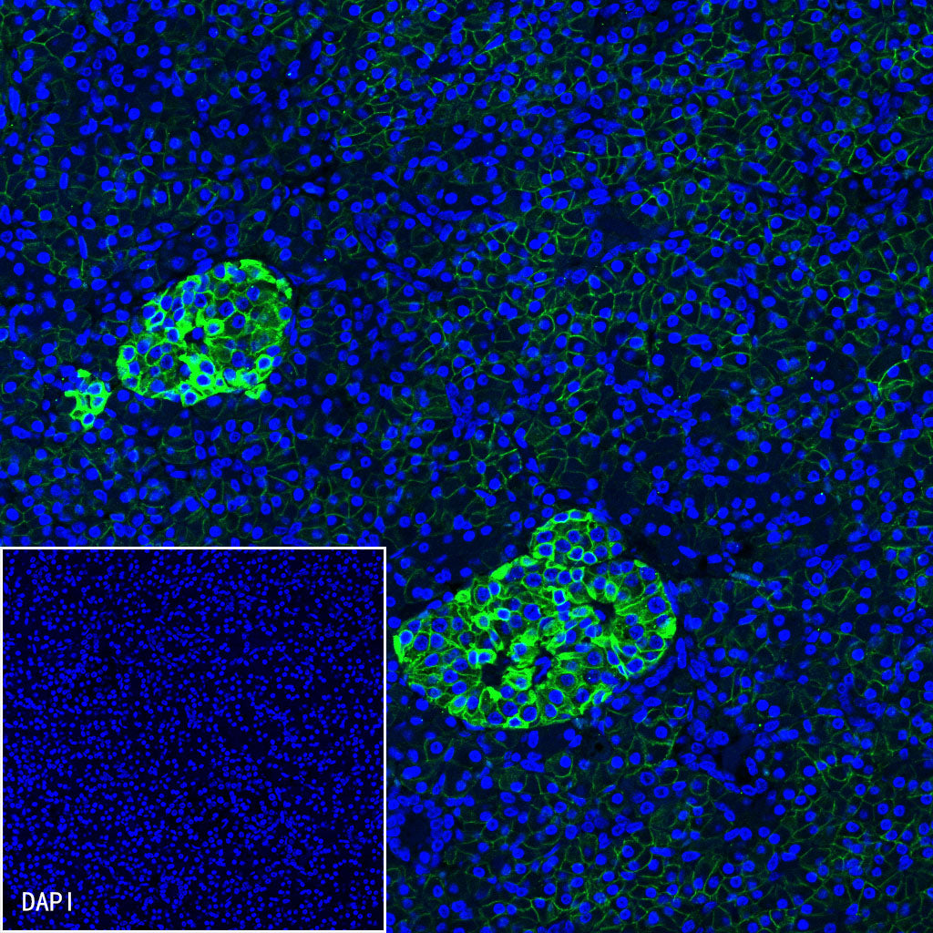 CD99 Recombinant Rabbit mAb (SDT-R122)