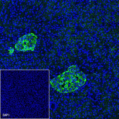 CD99 Recombinant Rabbit mAb (SDT-R122)