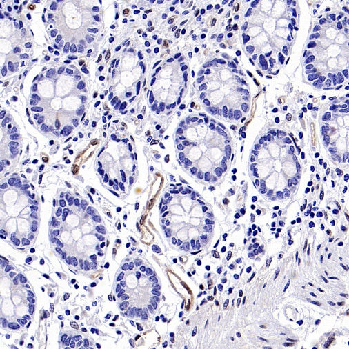 TAZ Recombinant Rabbit mAb (S-2812-102)