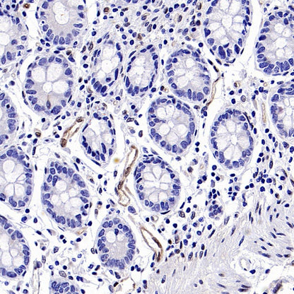 TAZ Recombinant Rabbit mAb (S-2812-102)