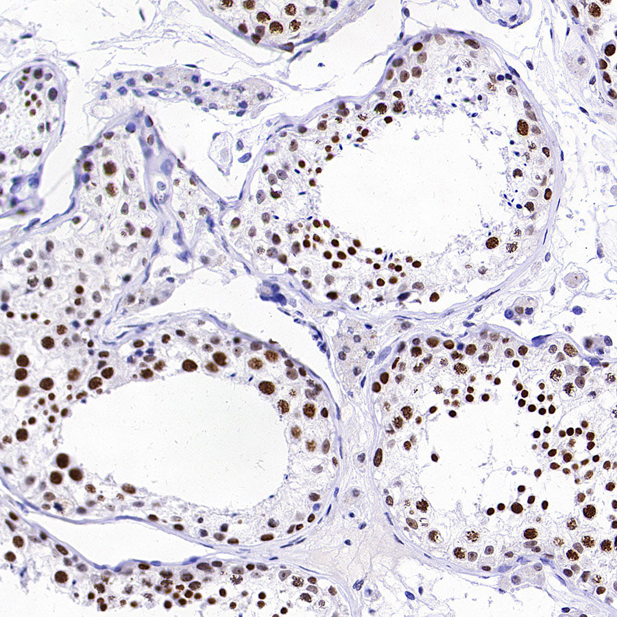 SMARCA3 Recombinant Rabbit mAb (S-3575-154)