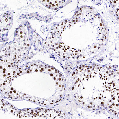 SMARCA3 Recombinant Rabbit mAb (S-3575-154)