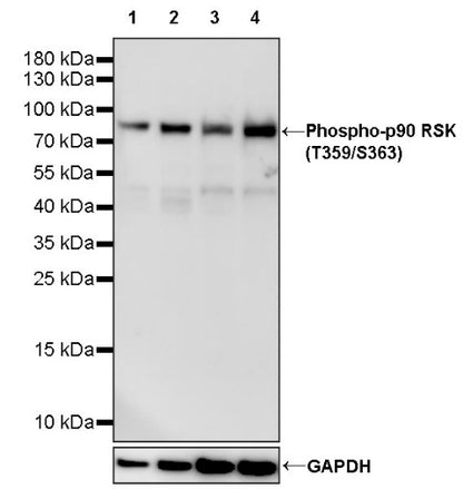 Phospho-p90 RSK (T359/S363) Recombinant Rabbit mAb (S-985-212)
