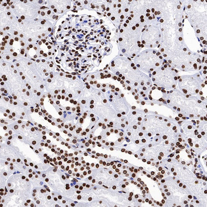 Histone H2B (mono methyl K5) Recombinant Rabbit mAb (S-1416-412)