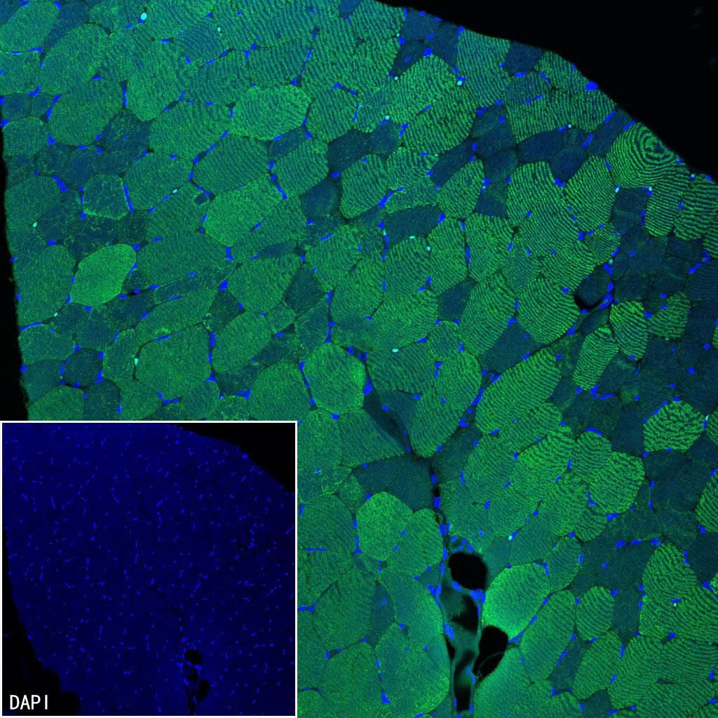 MYH7 Recombinant Rabbit mAb (S-4468-32)