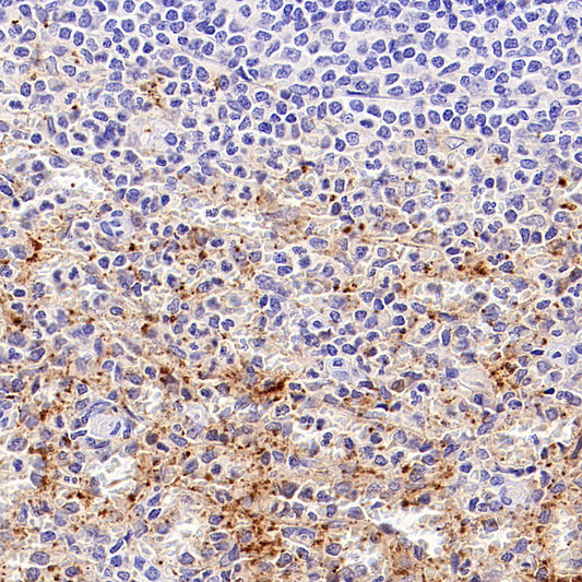 PF4 Recombinant Rabbit mAb (SDT-4218)