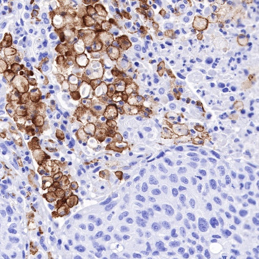 CD163 Recombinant Rabbit mAb (SDT-222-171)
