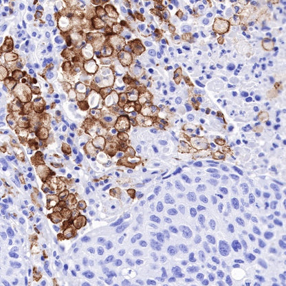 CD163 Recombinant Rabbit mAb (SDT-222-171)