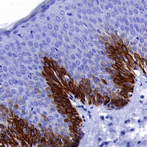CK-13 Recombinant Rabbit mAb (SDT-641-41)