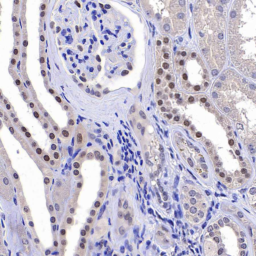 PAPSS1 Recombinant Rabbit mAb (S-3516-9)